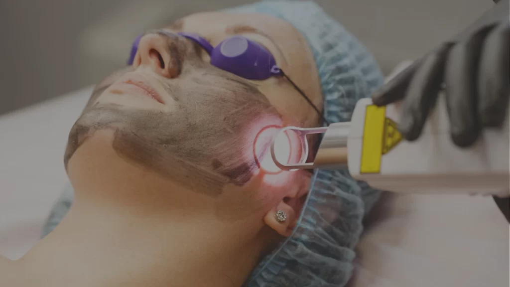 Precio de tratamiento laser co2 fraccionado en machala